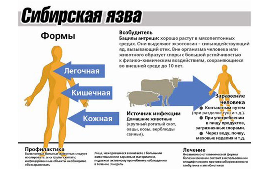 Сибирская язва инфекции презентация